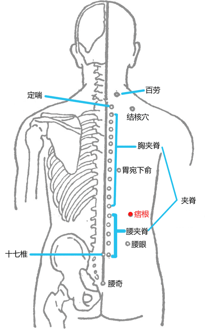 痞根