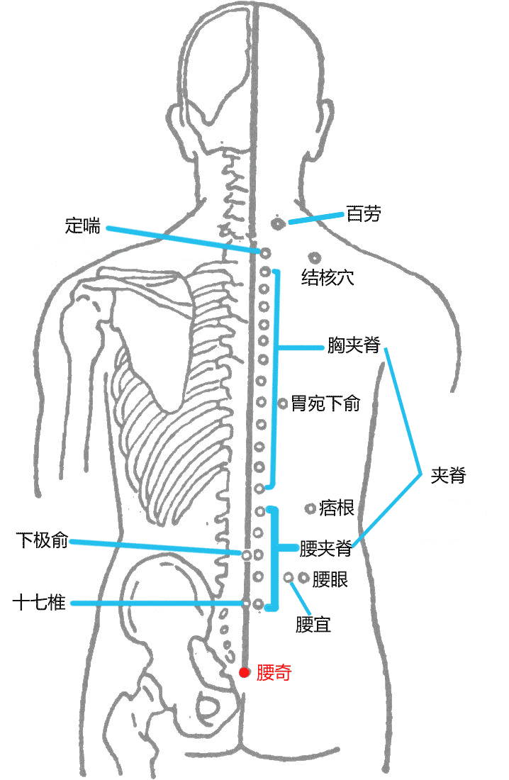 腰奇